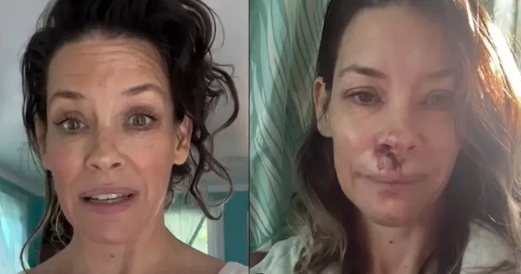 Ünlü oyuncu emekliliğin keyfini bile süremedi... Beyin sarsıntısı geçirdim... İyileşmek için çok para harcadım