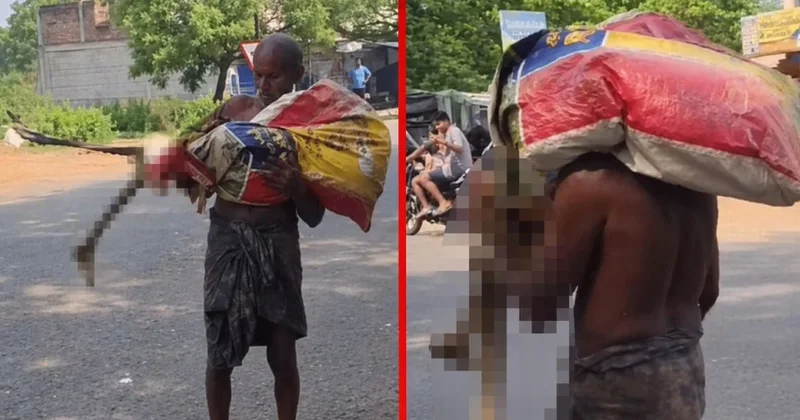 Akıllara durgunluk veren olay! Banka parayı vermeyince kız kardeşinin iskeletini şubeye götürdü Sözcü Gazetesi