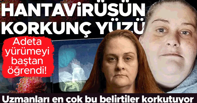 Hantavirüsün korkunç yüzü: Adeta yürümeyi baştan öğrendi! Uzmanları en çok bu belirtiler korkutuyor