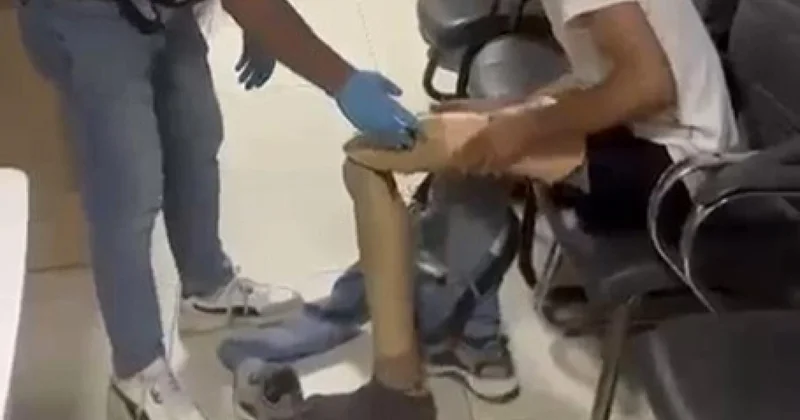 Protez bacağından 830 gram uyuşturucu çıktı