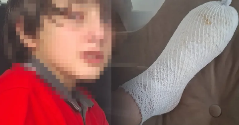AVM den alınan oyuncak küçük Furkan ın elinde patladı: Dehşet verici bir sesle seslendi