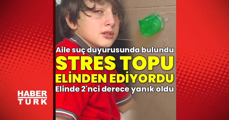SON DAKİKA HABERİ: 11 yaşındaki Furkan ın elini patlayan stres topu yaktı! Suç duyurusu