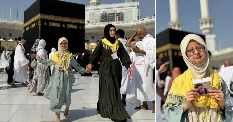 Nadir görülen gen hastası Esma Kabe hayaline kavuştu Aktüel Haberleri