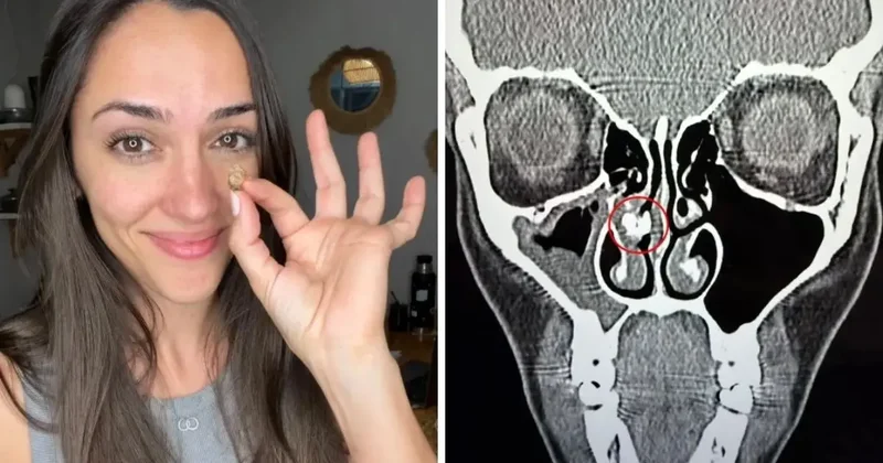 35 yıl sonra ortaya çıkan gerçek: Burnundan çıkan şeye kimse inanamadı