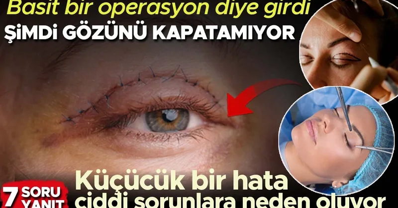 Basit bir operasyon diye girdi, şimdi bir gözünü tam kapatamıyor 7 SORUDA GÖZ KAPAĞI ESTETİĞİ
