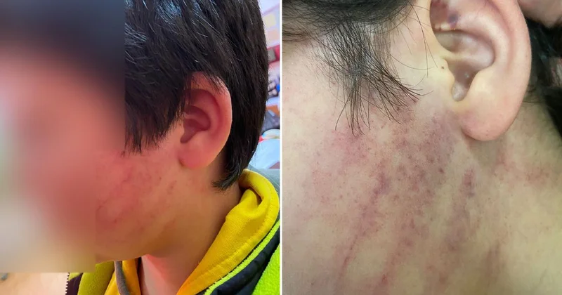 Bu kadarına da pes! Veliler okulda 8 yaşındaki çocukları dövdü