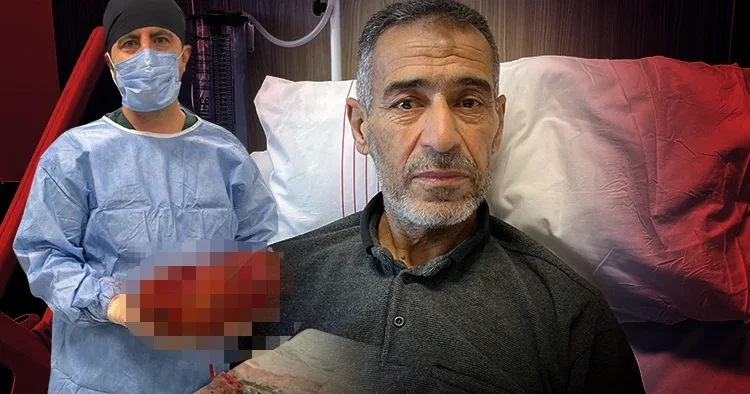 Ağrı şikayeti ile gitti, varılan teşhis doktorları da hayrete düşürdü Normalde yarım kilo yoktur, benimki 8 kiloya ulaşmıştı
