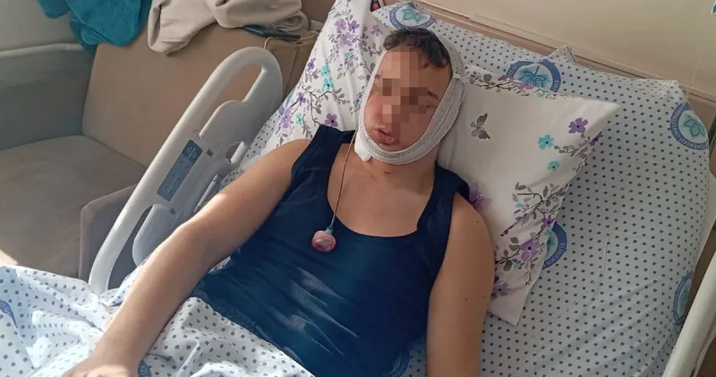 Liseli gencin çenesini kırmışlardı: 4 sanık ilk duruşmada tahliye oldu