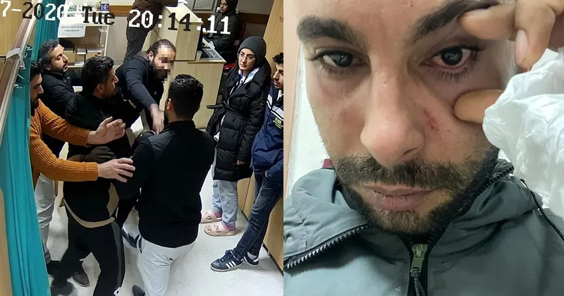 Doktor hastaya yumruk attı! Yüzde 30 görme kaybı...