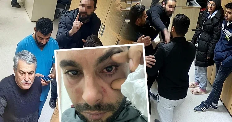 Doktordan hastaya yumruklu saldırı iddiası: Yüzde 30 görme kaybı oluştu Düşmanına vurur gibi yumruk atıyor