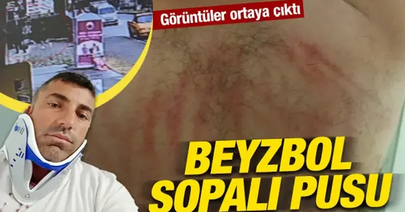 Samsun da beyzbol sopalı pusu: Can güvenliği kalmayan aile şehri terk etti