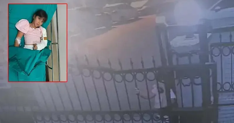 11 yaşındaki çocuğun kolu sürgülü kapıya sıkışıp kırıldı; aile şikayetçi oldu