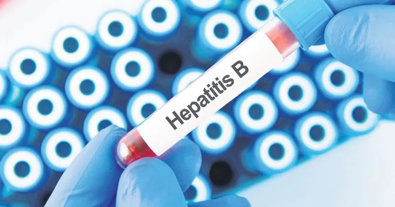 287 milyon kişi hepatit’in pençesinde