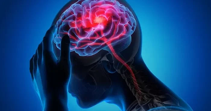 Nöroloji uzmanından inmeye karşı uyarı: Erken müdahale felci önler