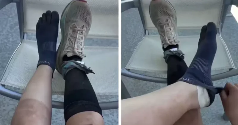 160 kilometre koşan sporcunun ayaklarının son hali inanılmaz