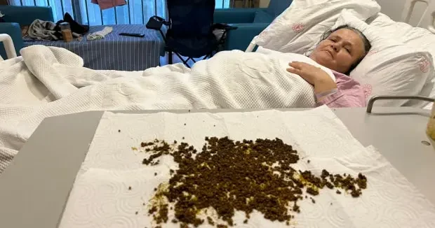 Manisa haberleri Doktorlar şoke eden vaka: Safra kesesinden 20 binin üzerinde taş çıktı! İşte o görüntü... 29 Kasım 2025