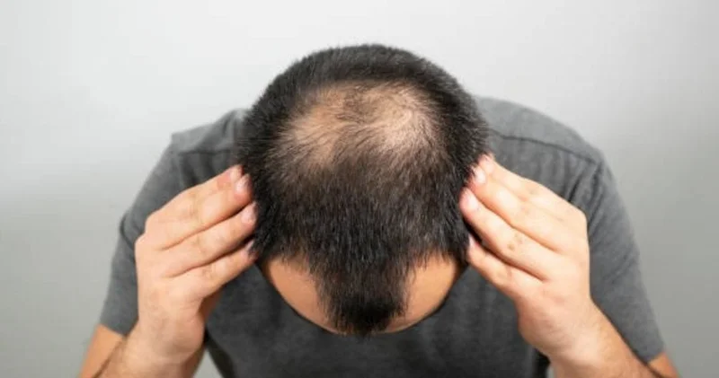 Bunu yapmayanın saçları dökülüyor ve erken yaşlanıyor