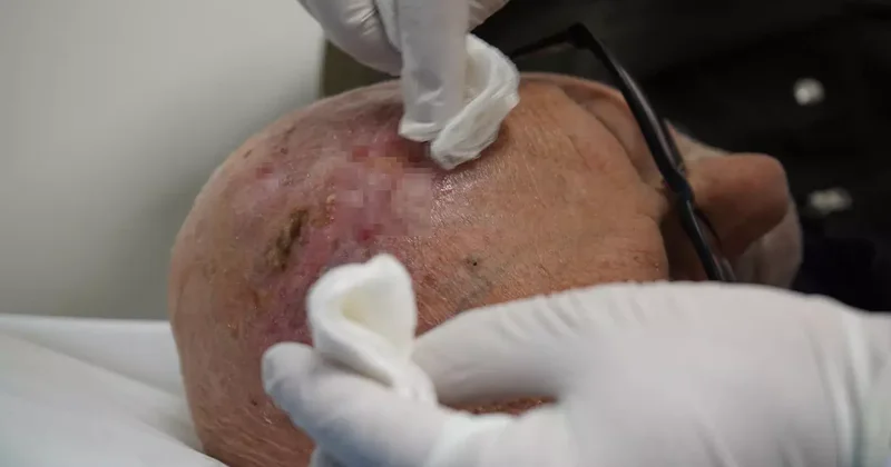 Dünyada iki örneği vardı, üçüncüsü Türkiye’de ortaya çıktı