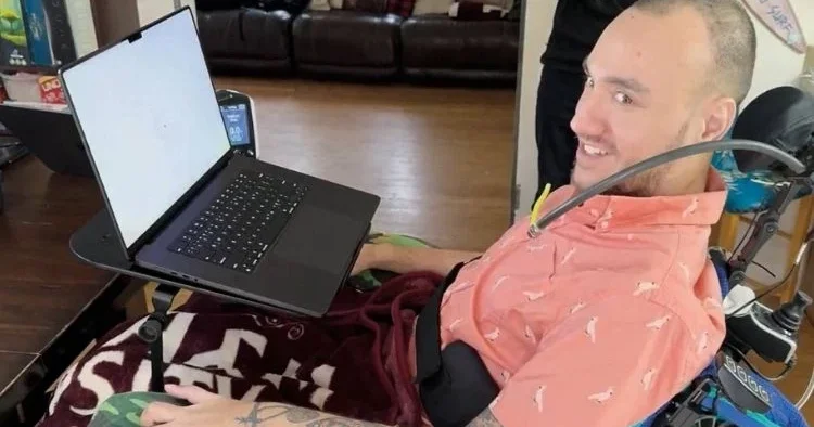 Beyin çipine 21 gönüllü