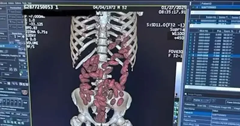 2025’te İstanbul Havalimanı’nda ‘yutucu’ kuryelerden 29,7 kilo uyuşturucu ele geçirildi