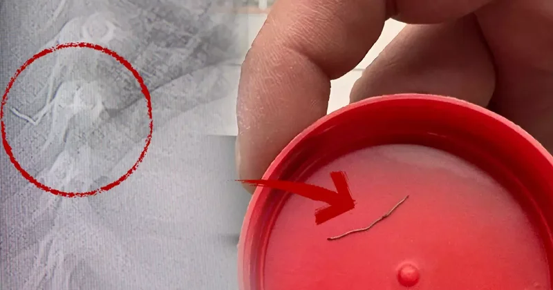 1 yaşındaki bebeğin sırtından 2 santimlik metal tel çıktı!