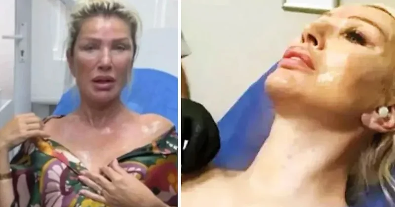 Güzellik sırrını açıkladı: Tavada pişen et gibi yaktırmış Sözcü Gazetesi