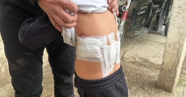 Saldırgan eşek evinin önünde oynayan 5 yaşındaki çocuğa kabusu yaşattı Eşeğin ısırması ve tekmelemesi sonrası ağır yaralanan çocuk hastaneye kaldırıldı Afyonkarahisar Haberleri