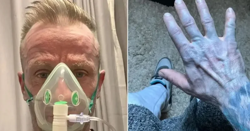 Sabah kalktığında cildi maviye dönmüştü: Öleceğini sanıp herkesle vedalaştı! Gerçek bambaşka çıktı Sözcü Gazetesi