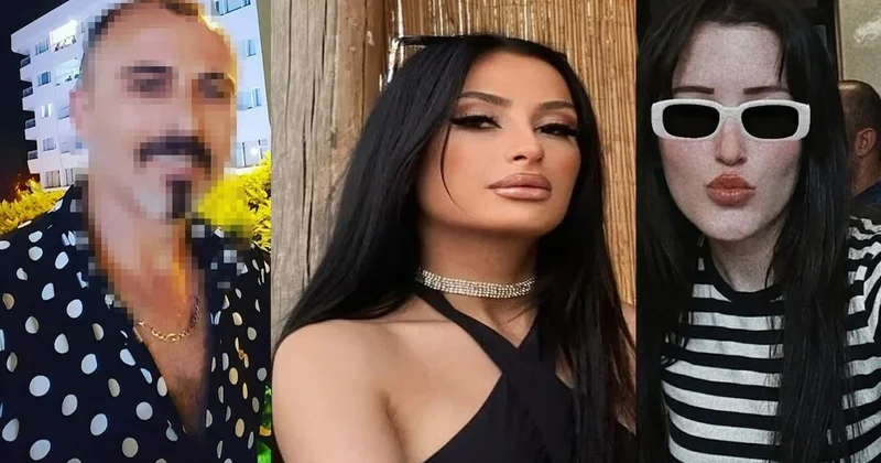 Otel önünde dehşet: 2 kadını öldürdü, polisi görünce kendini yaraladı Sözcü Gazetesi