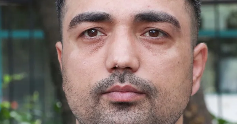 Burun ameliyatına girdi, başına gelmeyen kalmadı! İşini bile kaybetti
