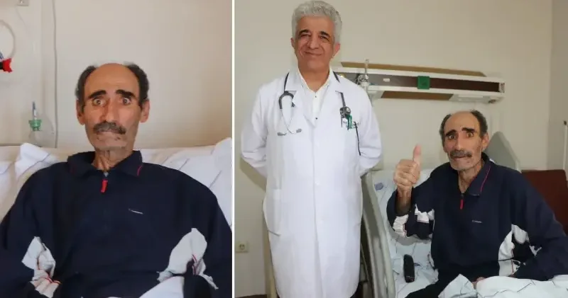 Hastanın akciğerinden alınan karpuz büyüklüğündeki kitle 30 yıllık cerrahı şaşırttı: Yüzde 20 ölüm riskiyle ameliyatı gerçekleştirdik Sağlık Haberleri