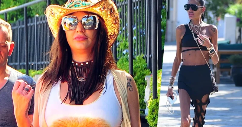 Bir deri bir kemik kalmıştı... Süreyya Yalçın son halini yorumlara kapatıp paylaştı Sözcü Gazetesi