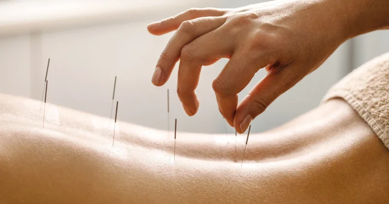 MS hastalarına akupunktur tedavisi