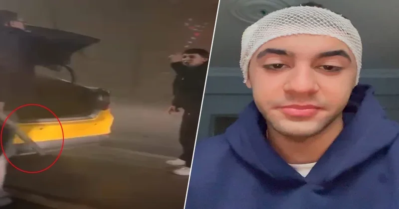 Tartışmaya girdiği taksicisi, motosiklet sürücüsünü sopayla yaraladı