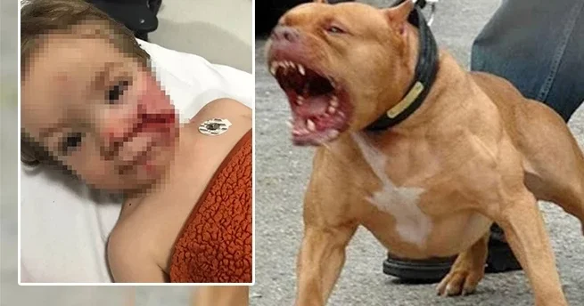 Ankara da pitbull dehşeti: Çocuğun yüzü paramparça oldu