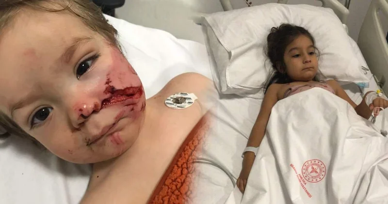 Pitbull saldırısında 1,5 ve 5 yaşındaki iki çocuk hastaneye kaldırıldı