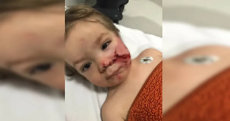 Ankara’da 1,5 ve 5 yaşındaki kardeşler pitbull saldırısına uğradı