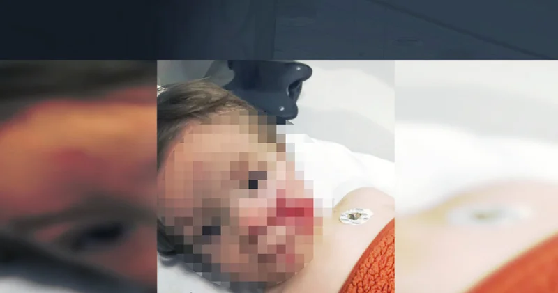 Ankara’da pitbull saldırısına uğrayan 1,5 ve 5 yaşındaki kardeşler yaralandı Son dakika haberleri