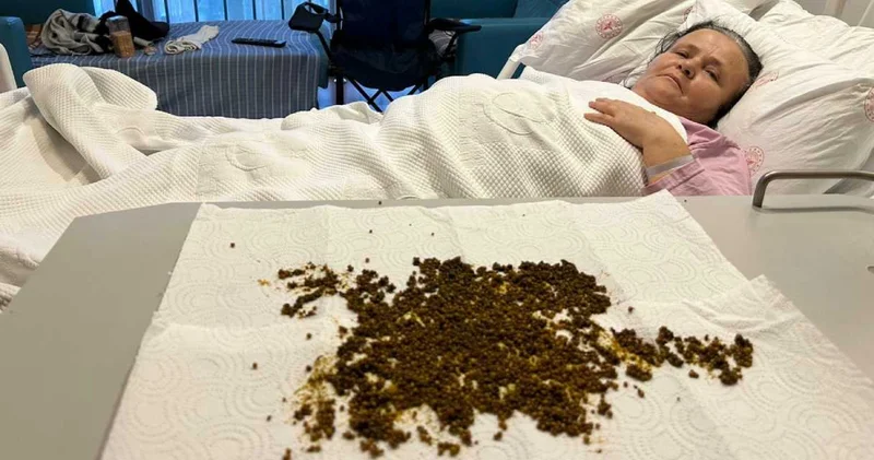 Türkiye de nadir görülen vaka! Karın ağrısıyla gitti 20 binden fazla taş çıktı