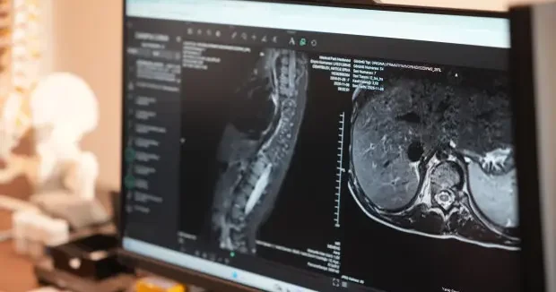 Kocaeli haberleri Anneler dikkat! Bu hastalığı ilk siz fark ediyorsunuz 30 Aralık 2025