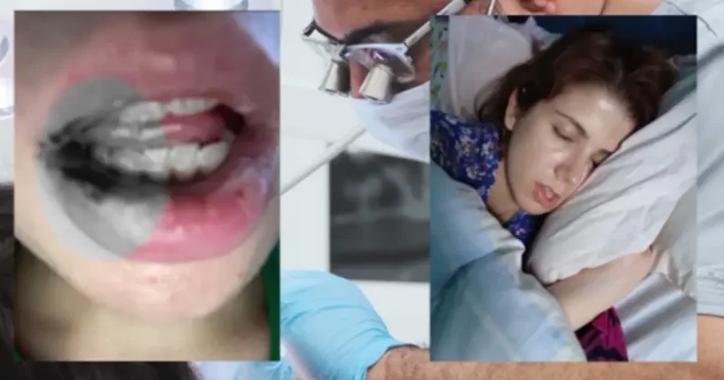 Kanal tedavisi hayatını kabusa çevirdi! İki yıl ağzımda paslı demirle yaşamışım