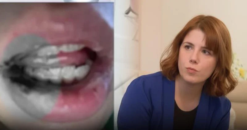 Ağzı çürüyünce gerçek ortaya çıktı! Dişinde eğe unutulmuş