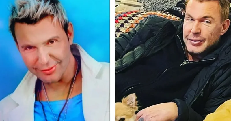 Kuşum Aydın estetik sonrası son halini paylaştı! Değişimi gündem oldu