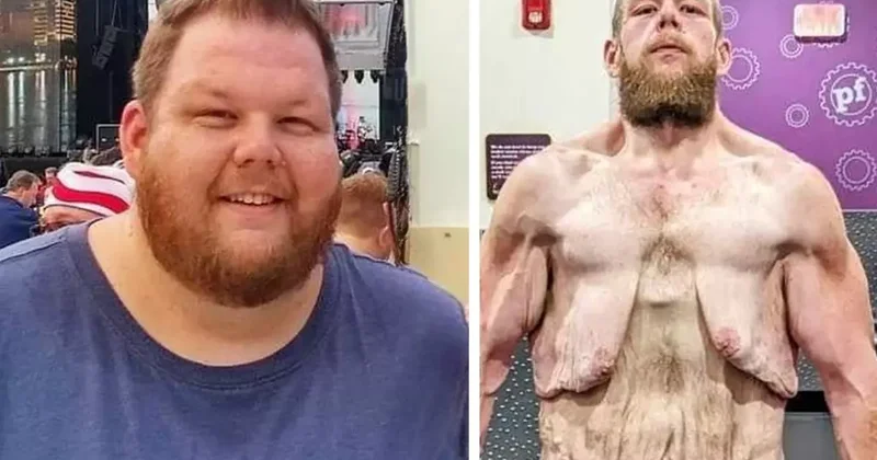 163 kilo verdi ama çilesi bitmedi