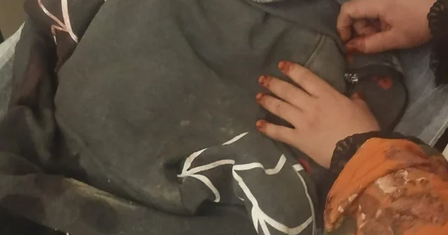 3 yaşındaki çocuğuna köpek saldıran baba: Köpeğin çocuğumuzu bırakması için çok uğraştık Kayseri de başıboş köpeğin saldırısına uğrayan çocuk 3 operasyon geçirdi Kayseri Haberleri