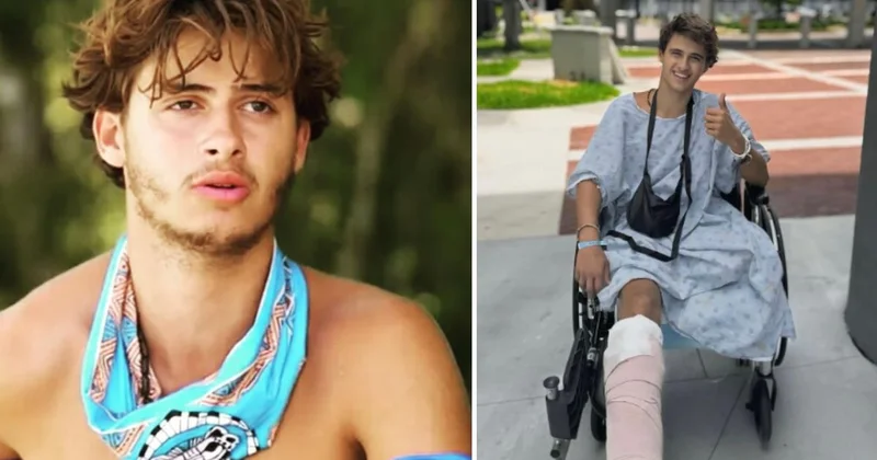 Survivor da bacağını kaybeden yarışmacıdan yeni paylaşım: Yeni hayatına alışmaya çalışıyor
