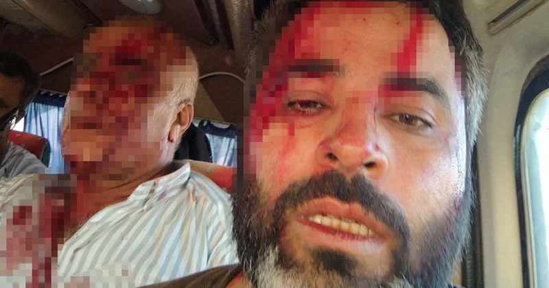 Meydan savaşı gibi kavga: Sopaları kılıç, taşları ok gibi kullandılar