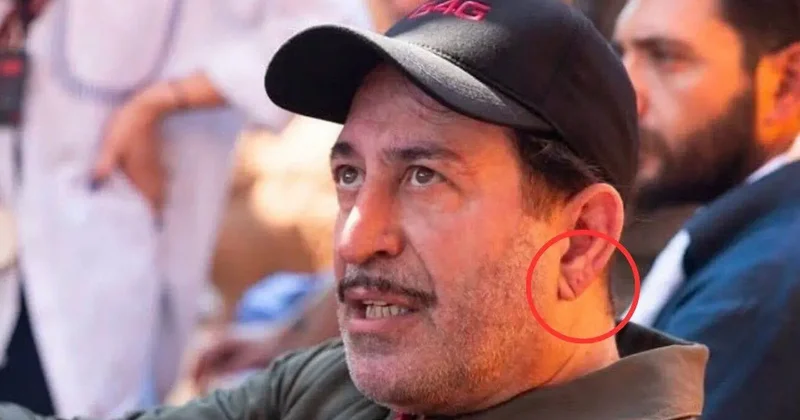 Cem Yılmaz ın rahatsızlığı sonrası gündem oldu: Kalp krizinin habercisi mi?
