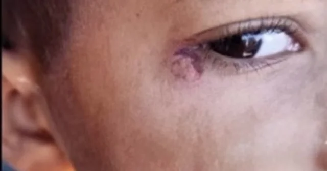 Öğrencinin yüzünde sigara söndüren temizlikçi tutuklandı Şanlıurfa Haberleri