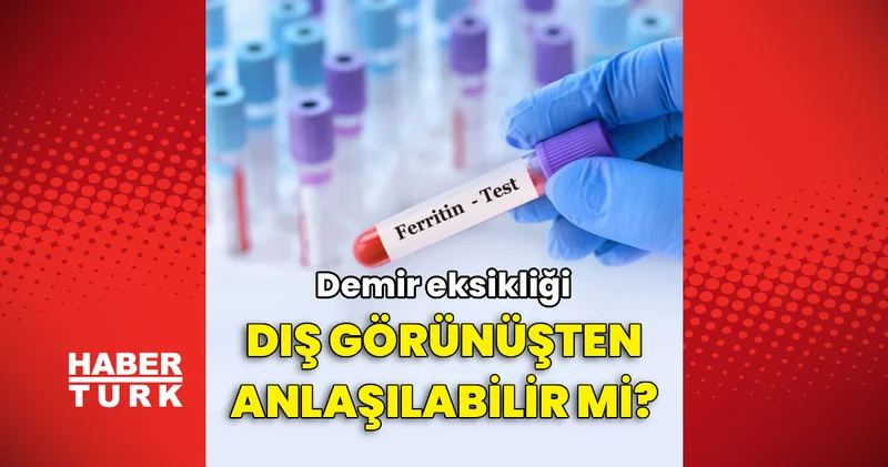 Demir eksikliği dış görünüşten anlaşılabilir mi?